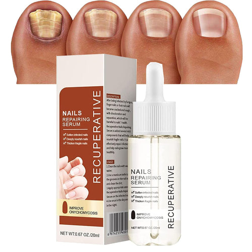 Serum para Uñas